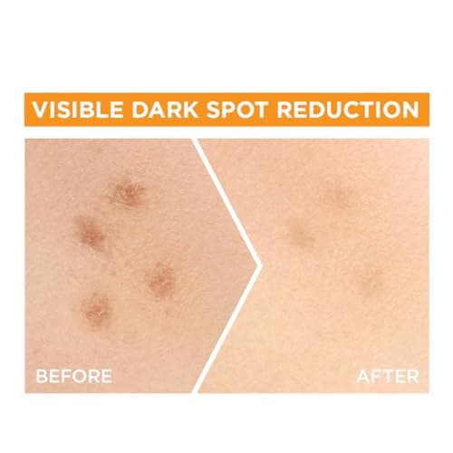 Garnier Skin Naturals, Face Serum, Brightening and Anti-Dark Spots, Bright Complete Vitamin C Booster, 15 ml (Pack of 2) 5