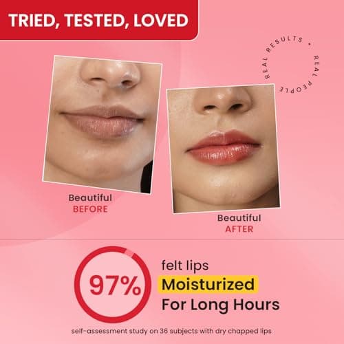 Dot & Key Strawberry Lip Balm (12gm) for Moisturization | Soft and Naturally Brightens Lips |Tinted Lip Balm with SPF 50 & Vitamin C + E | Lipbalm for Dry & Dark Lips | For Women 5