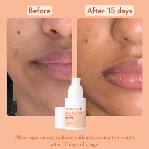 WishCare Super Bright C16 10% Vitamin C Serum For Glowing Skin | With 10% Vitamin C, Niacinamide & Kojic Acid | Face Serum For Women & Men | Reduces Pigmentation & Dark Spots | For Oily Skin, Dry & Co 4