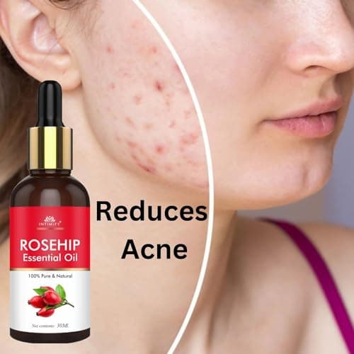 INTIMIFY Rosehip Oil For Face | Face Oil For Glowing Skin and Hair Growth | All Skin Types | Cold Pressed & Therapeutic Grade Carrier Oil | For Men & Women | 30 ml 3