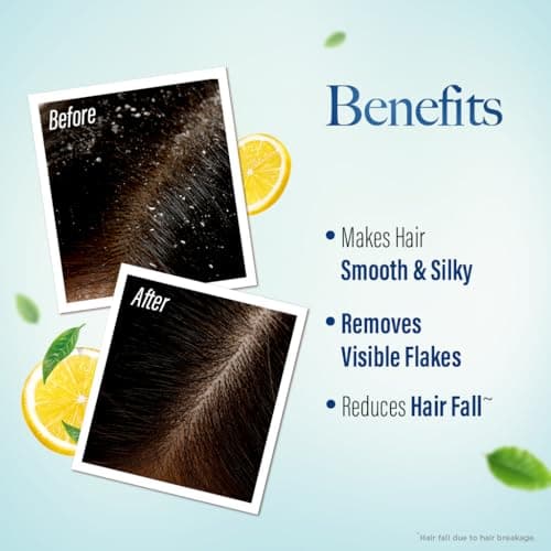 Kesh King Gold Anti-Dandruff Shampoo with 21 Herbs + Bio Niacinamide for Men & Women I 99% Users saw reduced dandruff in 2-weeks* I Eliminates dandruff & maintains scalp moisture, 1000ml 5