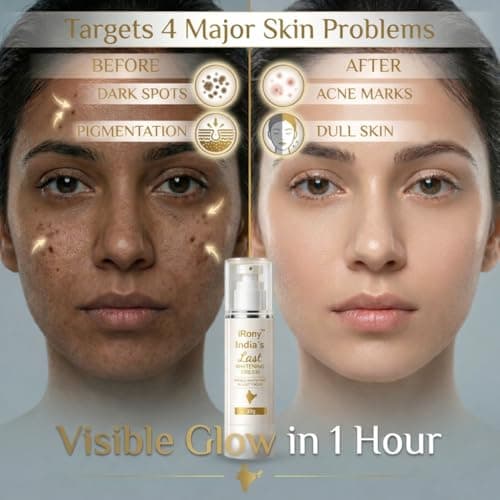 iRony India’s Last Whitening Cream | Instant Glow & Brightening in 1 Hour | Removes Dark Spots & Pigmentation | Smooth & Even Skin Tone | For Men & Women | 30g 2