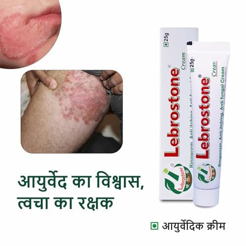 Lebrostone Cream Ayurvedic Treatment for Ringworm, Anti Itching, & Anti Fungal Infections (25 (Gram) Pack of 1, 25, gram) 2