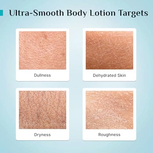 Pilgrim French Red Vine & Hyaluronic Acid Ultra Smooth Body Lotion | 48H Moisturization | Body lotion for dry skin | Infused With Shea Butter | For All Skin Types 400ml (400ml, Red Vine Ultra Smooth B 5