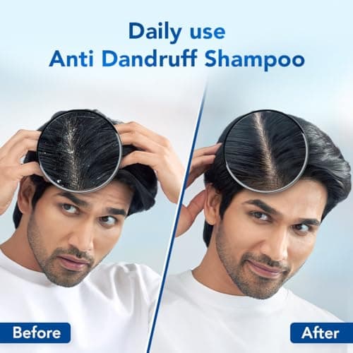 Scalpe Pro Daily Anti-Dandruff Shampoo | Removes Dandruff from Source | Prevents Itching & Irritation | Scalpe Science | Climbazole Formulation | Dermatologically Tested | For Women & Men | 400ml 2