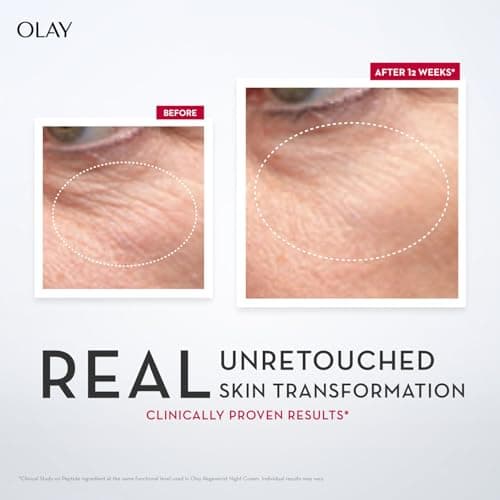 Olay Regenerist Micosculpting Serum | Hydrated, Plump, Bouncy Skin | With Hyaluronic Acid, Niacinamide and Peptides | Normal, Oily, Dry, Combination Skin | 50ml 3