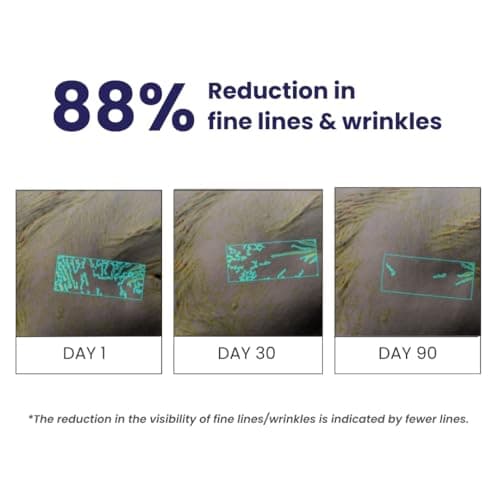 RE' EQUIL 0.1% Retinol Night Cream | Repairs Wrinkles & Fine Lines | Improves Skin Firmness | Beginner Friendly | All Skin Types | Anti Aging Cream For Women & Men 32G 5
