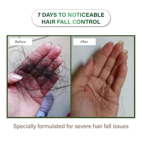 Niconi Herbal Hair Oil | Suitable for Men & Women | Applicator Bottle|Helps Reduce Hair Fall & Dandruff | Contains Coconut, Rosemary, Castor, Bhringraj, Eucalptus, Shikakai, Methi, Bhrami, Neem Oil |  4