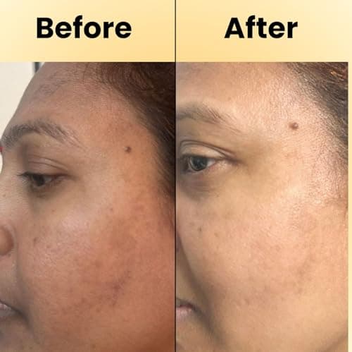 D’Radiant+ Advance Vitamin C 10% Face Serum with Alpha Arbutin and Niacinamide | 7 Active Ingrediants | Skin Brightening, Anti-Aging & Dark Spot Removal | Dermatologically & Clinically Tested(30ml) 2