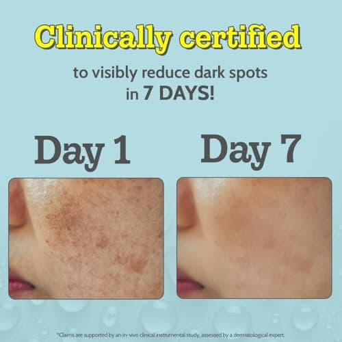 Chemist At Play 10% Vitamin C Serum for Glowing Skin | Pigmentation & Dark Spots | Skin Brightening Face Serum | With Ethyl Ascorbic Acid, Lactic Acid & Glucosamine | For Men & Women | 30 ml 2