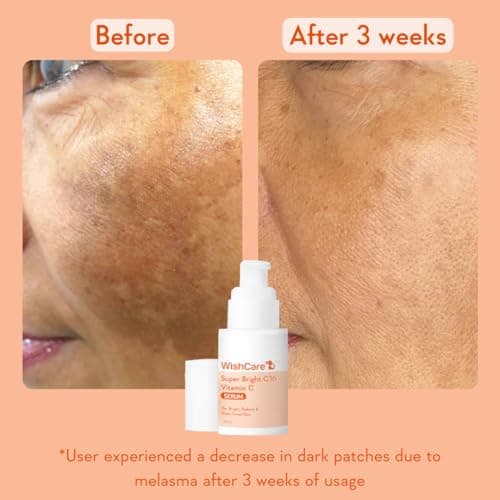 WishCare Super Bright C16 10% Vitamin C Serum For Glowing Skin | With 10% Vitamin C, Niacinamide & Kojic Acid | Face Serum For Women & Men | Reduces Pigmentation & Dark Spots | For Oily Skin, Dry & Co 5