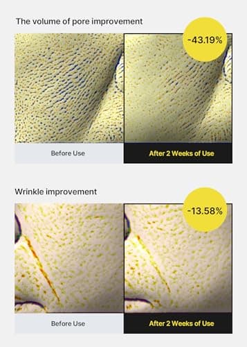 Celimax The Vita-A Retinol Shot Tightening Serum with Pure Vitamin-A, 0.1% Retinol, 9 Peptides & Panthenol for Pore Minimizing, Wrinkles & Fine Lines, Firmer Skin, Anti-Aging, Skin Smoothing (30ml) 4