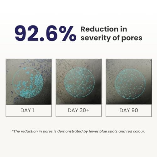 RE' EQUIL 0.3% Retinol Night Cream, Improves Skin Texture, Reduces Acne, Unisex, For All Skin Types, 32G 5