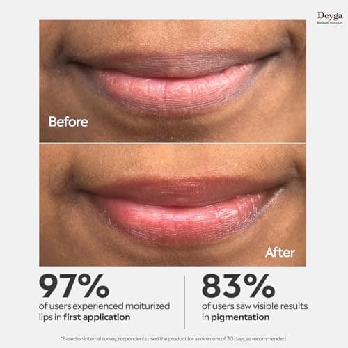 Deyga Beetroot Lip Balm | Tinted Lip Care | For Dry & Chapped Lips | For Pigmented Lips | For Women & Men (Pack of 1, Stick Lip Balm), Red 2