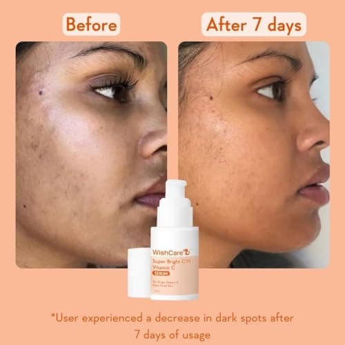 WishCare Super Bright C16 10% Vitamin C Serum For Glowing Skin | With 10% Vitamin C, Niacinamide & Kojic Acid | Face Serum For Women & Men | Reduces Pigmentation & Dark Spots | For Oily Skin, Dry & Co 3