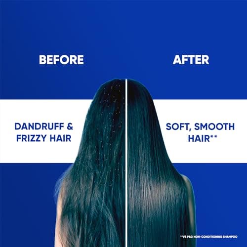 Head & Shoulders , Anti Dandruff Shampoo + Conditioner, Smooth & Silky, 180 ML 5