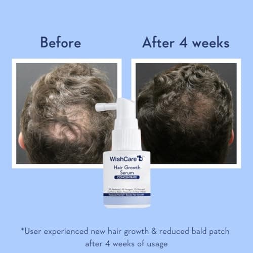 WishCare Hair Growth Serum Concentrate - Resdensyl, Anagain, Caffeine, Biotin, Keratin & Rice Water 20ml 3