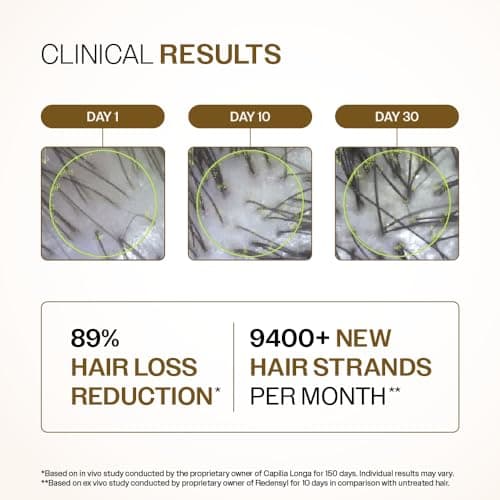 Bare Anatomy Advanced Hair Growth Serum | 3% Redensyl, 4% Anagain, 3% Baicapil, 1% Capilia Longa, Rosemary, Biotin & Rice Extract | Hairfall control & Hair Density | Women & Men | 30ml 4