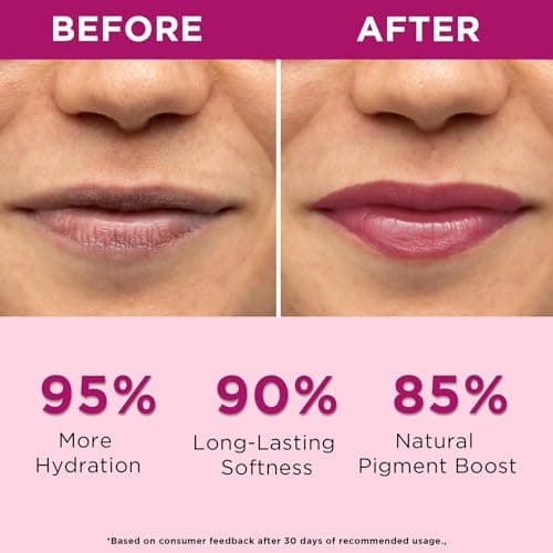 Orgatre Beetroot Lip Balm Tube with Ceramide, Kojic Acid & SPF 30 PA++ | Deep Moisturization & Pigmentation Care | Natural Beetroot Tint | Nourishes, Repairs & Protects Lips | 10ml - Pack of 2 2