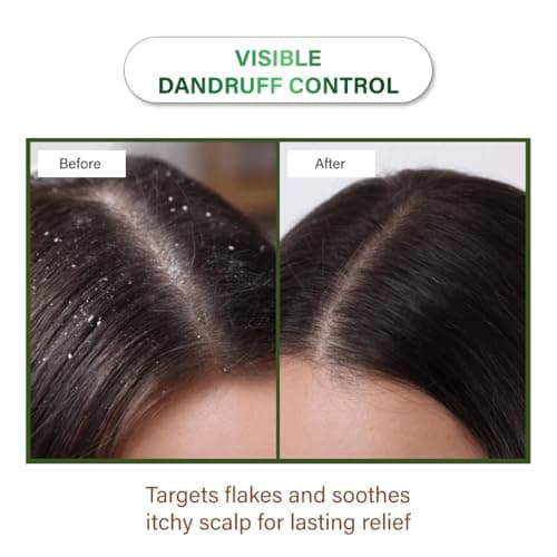 Niconi Herbal Hair Oil | Suitable for Men & Women | Applicator Bottle|Helps Reduce Hair Fall & Dandruff | Contains Coconut, Rosemary, Castor, Bhringraj, Eucalptus, Shikakai, Methi, Bhrami, Neem Oil |  3