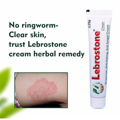 Lebrostone Cream Ayurvedic Treatment for Ringworm, Anti Itching, & Anti Fungal Infections (25 (Gram) Pack of 1, 25, gram) 3