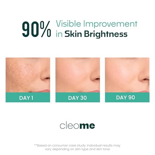 Cleome Skin Brightening Cream for Women & Men with Kojic Acid, Glycolic Acid & Alpha Arbutin | Pigmentation Cream for Dark Spots & Uneven Tone | Non-Comedogenic | Dry, Oily, Acne Prone & Normal Skin | 5