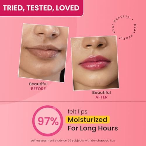 Dot & Key Cherry Lip-Balm SPF 50 (12gm) | Moisturization |For Smooth and Brightening | Shea Butter with Vitamin E | Tinted Lip-Balm for Glossy, Buttery Soft Lips | with Vitamin C for Dark Lips | For W 5