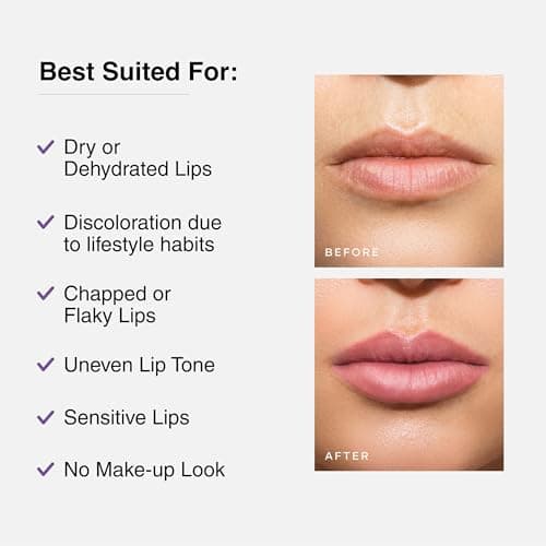 Cureskin Tinted Lip Balm For Women And Men |Hydrates & Protects For Lip Tint With Beetroot,Carrot & Strawberry |Lip Lightening Balm For Dark Lips |Tinted Lip Balm For Dark Lips To Lighten,1 Count 4