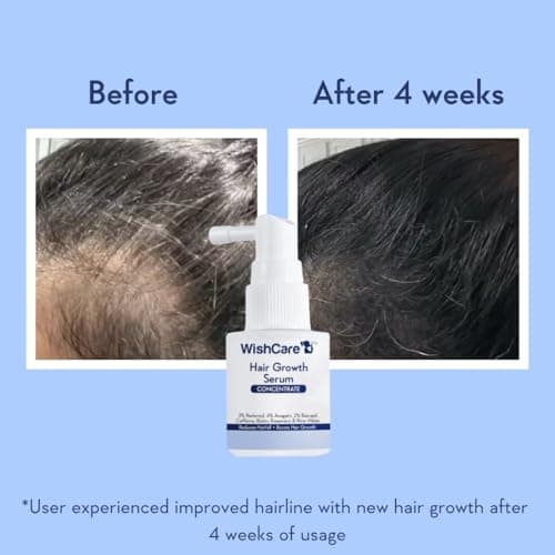 WishCare Hair Growth Serum Concentrate - Resdensyl, Anagain, Caffeine, Biotin, Keratin & Rice Water 20ml 4