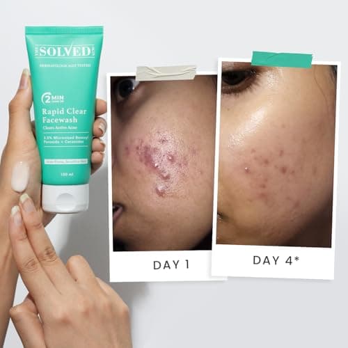 THE SOLVED SKIN Acne Clearing & Barrier Repair Combo - India's 1st Derma-Tested System with Micronized Benzoyl Peroxide & Lamellar Liquid Technology | Kills 99% Acne Bacteria & Reduces Scars, Redness  3