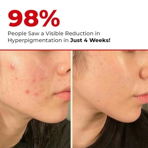 Conscious Chemist® Rapid Glow & Brightening Essence | Face Serum with 5 Antioxidant Complex (100X Stronger Than Vitamin C), Vitamin E & Retinol | For Radiant, Even-Toned Skin, For Men & Women, All Ski 2