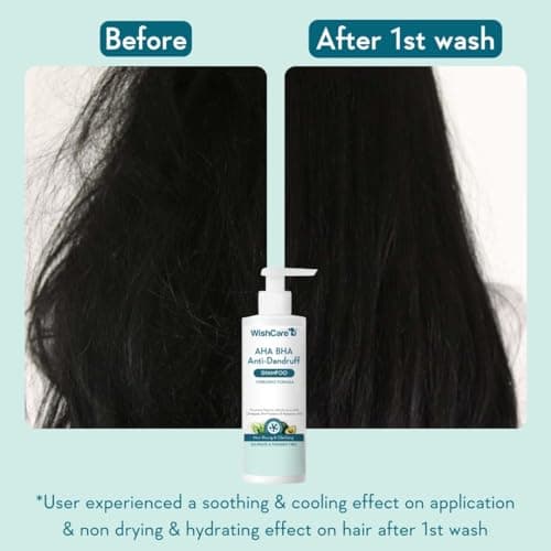 WishCare Hydrating Anti Dandruff Shampoo | 100% Dandruff Reduction | Removes Flakes & Hydrates Scalp | Proven Clinically | Piroctone Olamine, Salicylic Acid, AHA & BHA | Paraben & Sulphate Free | For  5