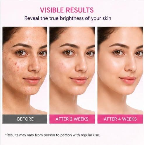 Beauty Cream for Women and Men| Fair tone| Radiance Face Cream for Glowing Skin | Brightening Cream for Dark Spots, Acne Marks & Pigmentation | Lightweight Moisturizer for All Skin Types 60g 2