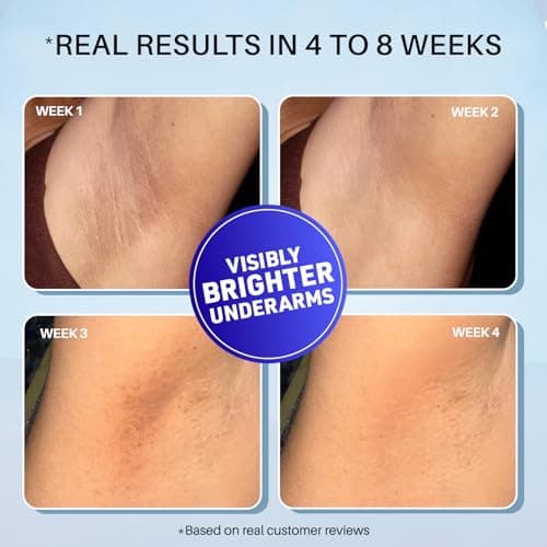 DermDoc 5% Glycolic Acid Underarm Brightening Spray Treatment (100 Ml)|Multipurpose Exfoliating Toner For Dark Spots On Face & Body|Helps With Dark Neck & Knees,Strawberry Legs With 5% Salicylic Acid 3