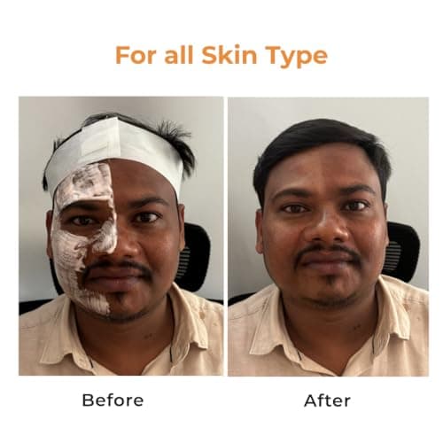 NICONI Gluta-Kojic Skin Polish | D-Tan Professional Face Pack for Brightening & Glow | Instant Tan Removal & Dead Cell Exfoliation | Smooth Radiant Finish | 180g 4