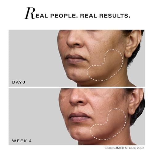 Novology Pro-Lift Cellular Restoration Anti-Ageing Serum with 5.3% Pro Retinol + Adenosine Triphosphate + Peptides| For Firmer Skin, Reduces Fine Lines & Wrinkles| 28 ML 6