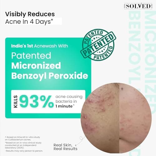 THE SOLVED SKIN Acne Clearing & Barrier Repair Combo - India's 1st Derma-Tested System with Micronized Benzoyl Peroxide & Lamellar Liquid Technology | Kills 99% Acne Bacteria & Reduces Scars, Redness  2