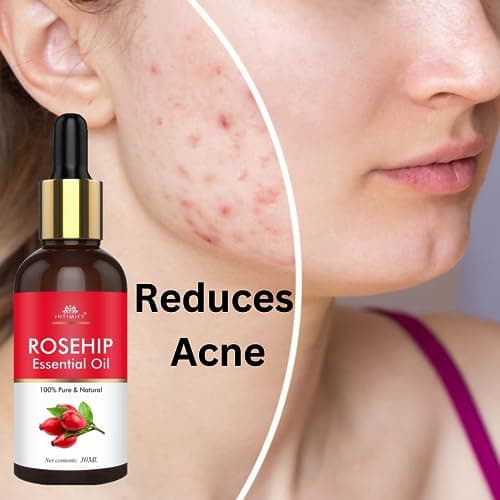 INTIMIFY Rosehip Oil For Face | Face Oil For Glowing Skin and Hair Growth | All Skin Types | For Men & Women | 30 ml 5