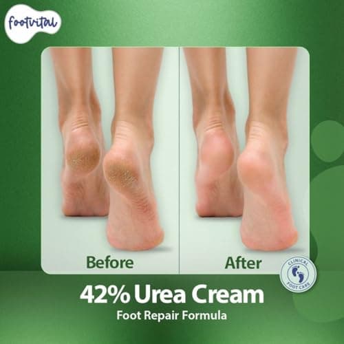 Footvital 42% Urea Cream for cracked heels with 2% Salicylic Acid 200 g | intensive foot repair formula | skin-friendly | dermatologist-approved 5