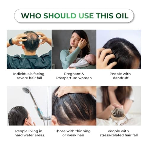 Niconi Herbal Hair Oil | Suitable for Men & Women | Applicator Bottle|Helps Reduce Hair Fall & Dandruff | Contains Coconut, Rosemary, Castor, Bhringraj, Eucalptus, Shikakai, Methi, Bhrami, Neem Oil |  5
