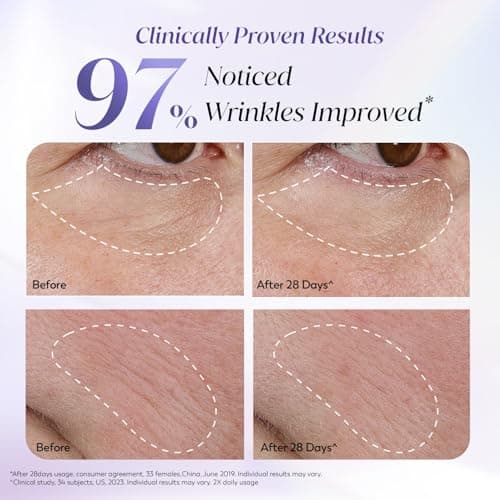 Olay Retinol24 Max Night Serum l Visibly Reduces Fine Lines in 7 Nights | Max Repair, Max Hydration l No Redness or Irritation | Fragrance Free l Normal, Oily, Dry and Combination Skin l 30ml 3