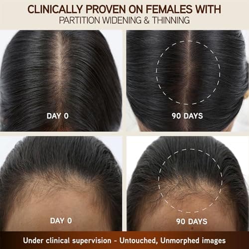 Indulekha Bringha Hair Growth Treatment Scalp Serum with Bringha, Rosemary and Amla for Hair Growth, 30 ml 5