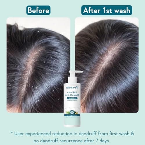 WishCare Hydrating Anti Dandruff Shampoo | 100% Dandruff Reduction | Removes Flakes & Hydrates Scalp | Proven Clinically | Piroctone Olamine, Salicylic Acid, AHA & BHA | Paraben & Sulphate Free | For  3