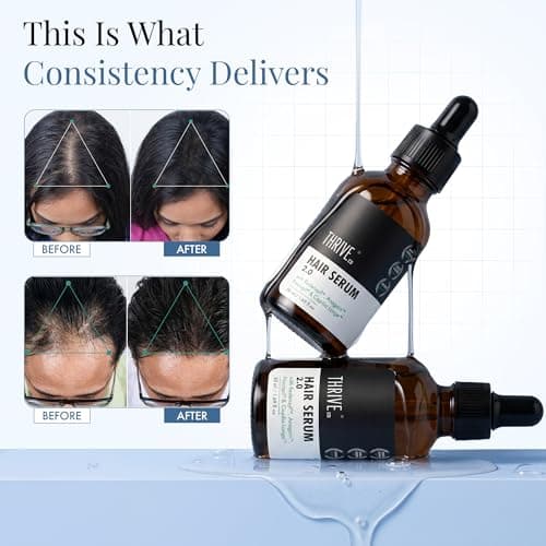 ThriveCo Hair Growth Serum For Scalp, 50ml |Advanced Patent Filed Clinically Proven Scalp Treatment for Hair Fall Control & Regrowth | British Medical Publication | Redensyl, Anagain, Regendil®, Rosem 4