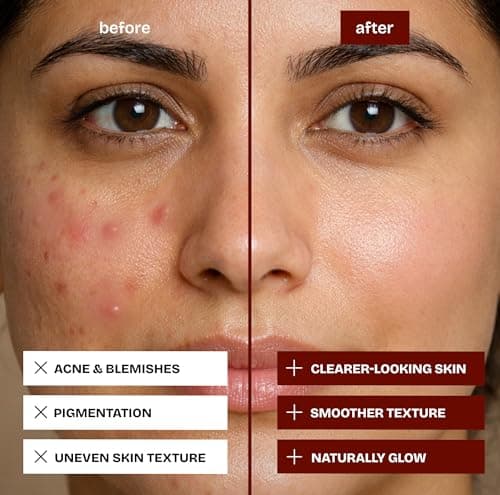 Kumkumadi Oil Face Serum (15ml) | Pure Ayurvedic Anti-Aging Serum | Kumkumadi Tailam for Face Dark Spots, Wrinkles | kumkumadi oil serum for face 2