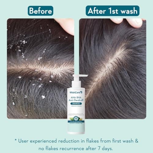 WishCare Hydrating Anti Dandruff Shampoo | 100% Dandruff Reduction | Removes Flakes & Hydrates Scalp | Proven Clinically | Piroctone Olamine, Salicylic Acid, AHA & BHA | Paraben & Sulphate Free | For  4