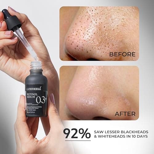 Communal Retinol 0.3% Face Serum 30ml with Hyaluronic Acid & Squalane | Anti Aging Retinol Serum for Fine Lines, Wrinkles & Uneven Texture | Hydrating Night Serum for Oily & Dry Skin 5