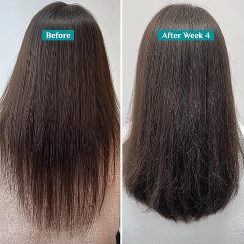 Pilgrim Redensyl & Anagain Hairfall Control Shampoo with Korean Black Rice 400ml | Anti Hairfall shampoo for Men & Women | Reduces Hairfall | Promotes Hair Thickness | For All Hair Types 5
