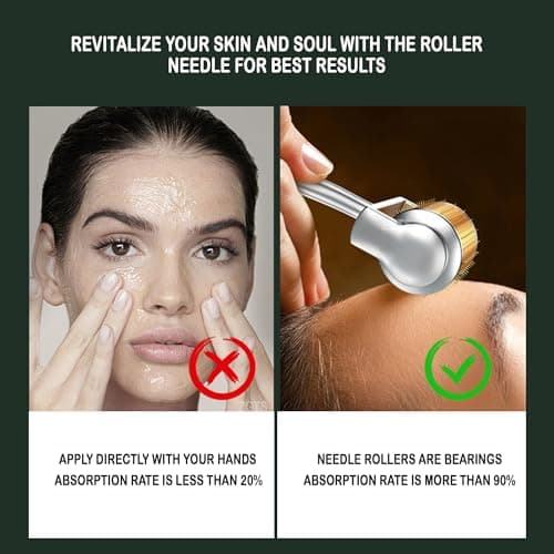 ZGTS Professional Gold Plated 192 Needles Titanium Alloy Derma Roller, Gold, 0.5mm 2