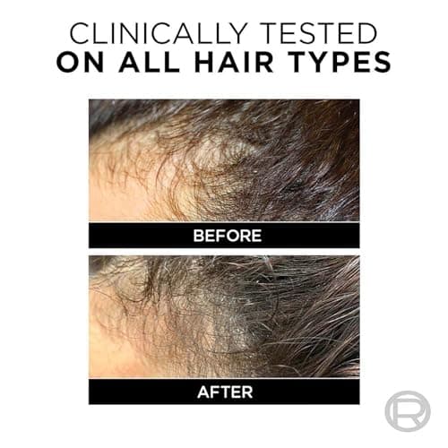 L'Oreal Paris Anti-Hair Fall Shampoo, Reinforcing & Nourishing for Hair Growth, For Thinning & Hair Loss, With Arginine Essence and Salicylic Acid, Fall Resist 3X, 340ml 5